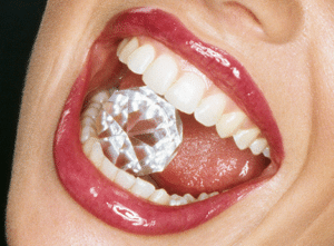 Diamonds are a tooth’s best friend. #Gallery57Dental #diamonds #tooth