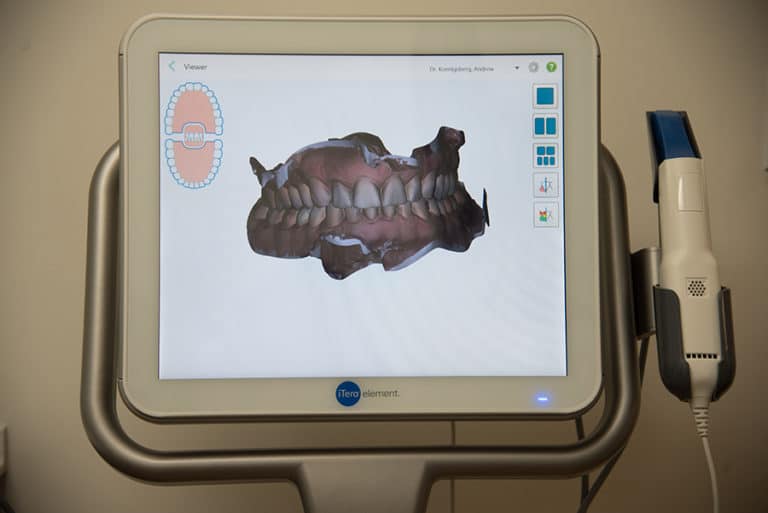 Itero Full Mouth scan screen Gallery 57 Dental