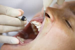 Solea Laser Dentistry NYC | Laser Dentistry Manhattan | Painless Dentistry