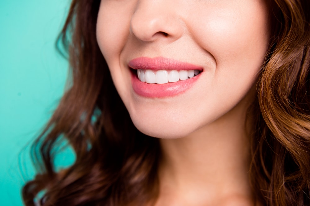 Pretty young white woman has bright white teeth thanks to her new veneers.