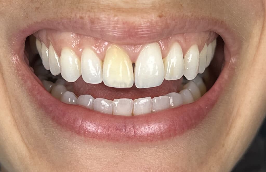 GP smile before